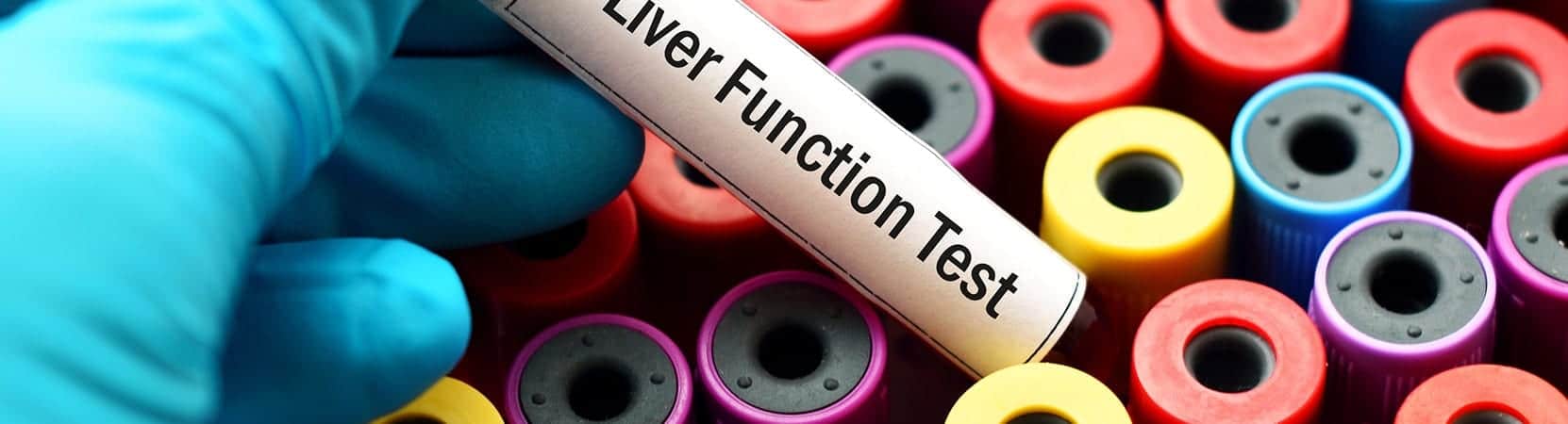 Functional Laboratory Analysis Heyworth 